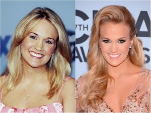 carrie underwood before and after fans reactions