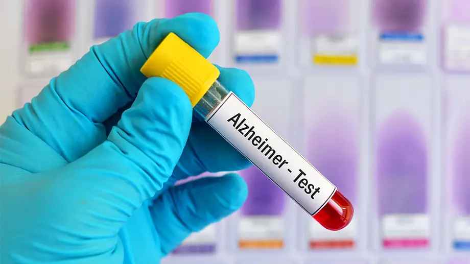 Alzheimer's Blood Test