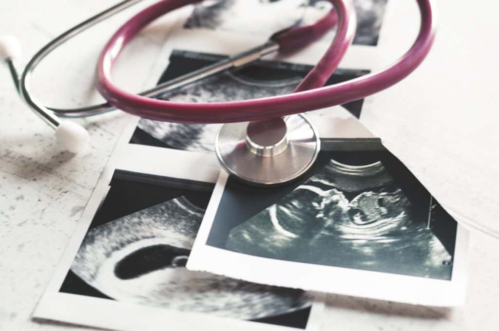 Survey Reveals Slight Uptick in Abortions in the U.S. Following New Restrictions