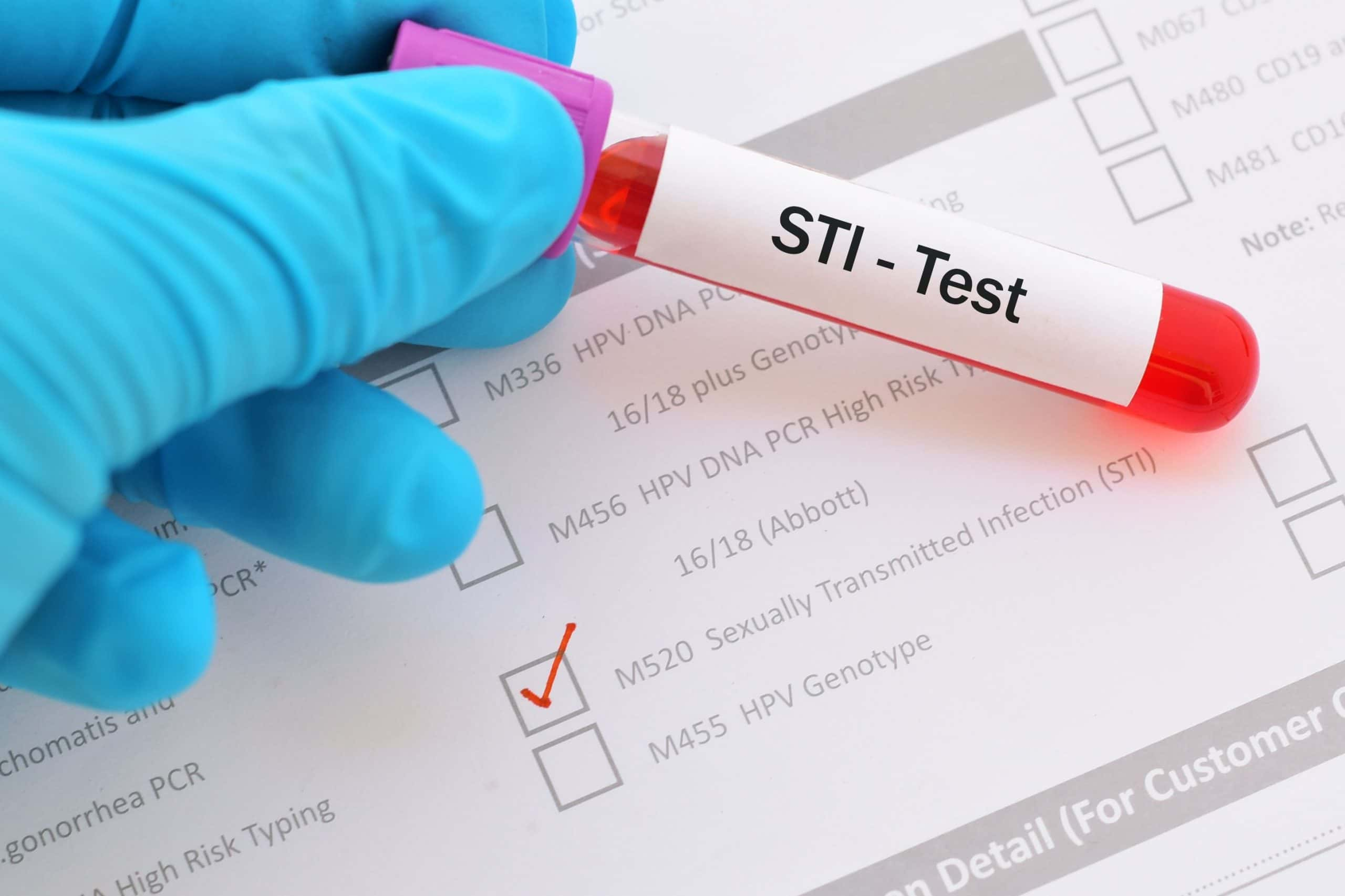 STI At-Home Test For Chlamydia And Gonorrhea