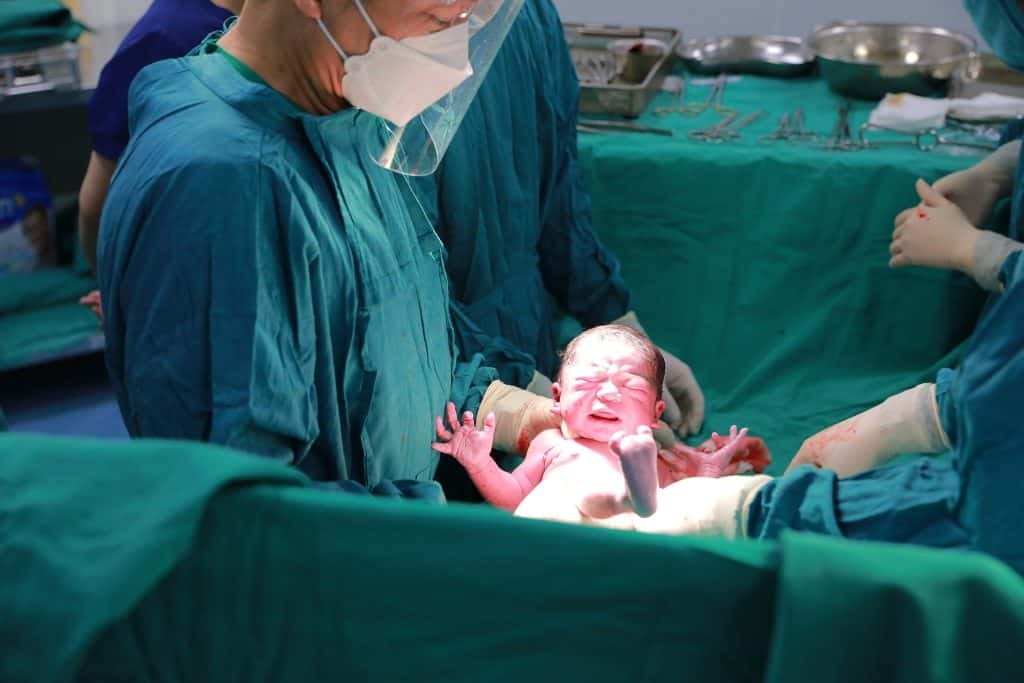 Delaying Umbilical Cord Clamping