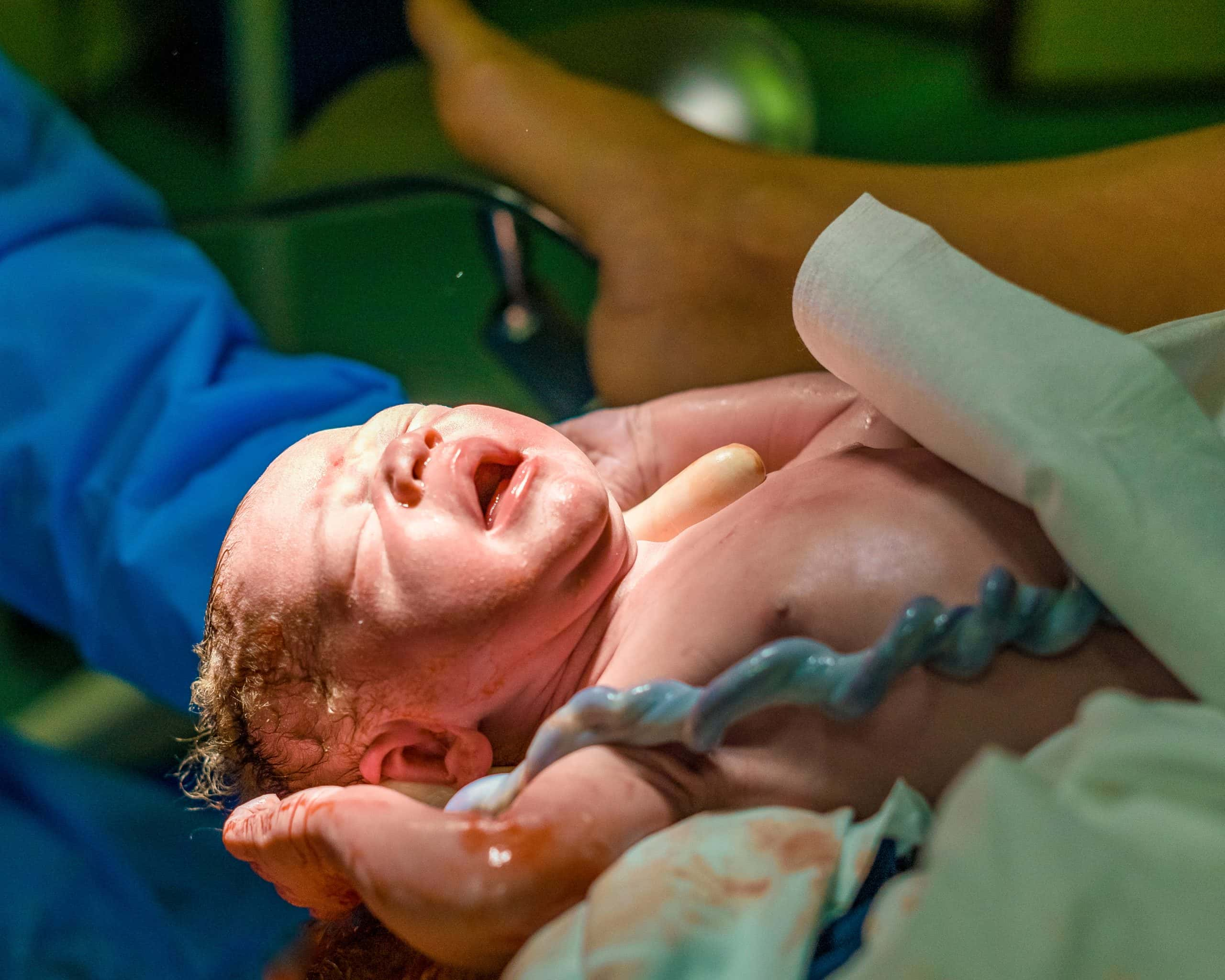 How Delaying Umbilical Cord Clamping For More Than Minutes Can Save Premature Babies From Death