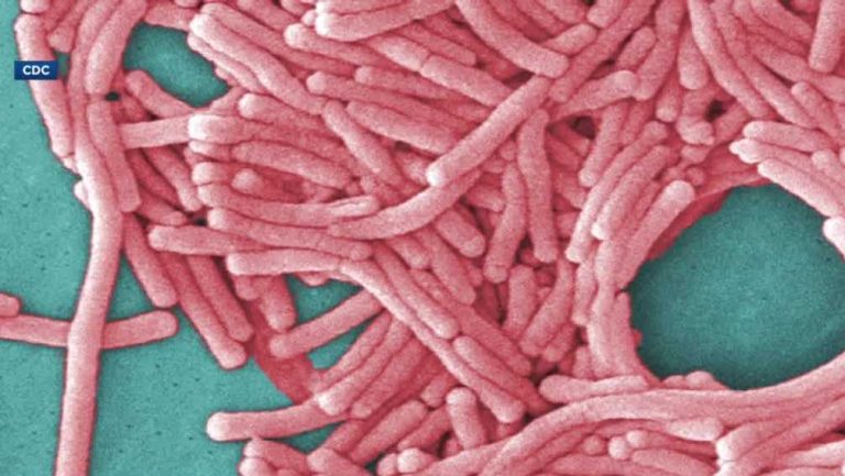 Legionnaires’ Disease Outbreak at New Hampshire Resort Claims One Life