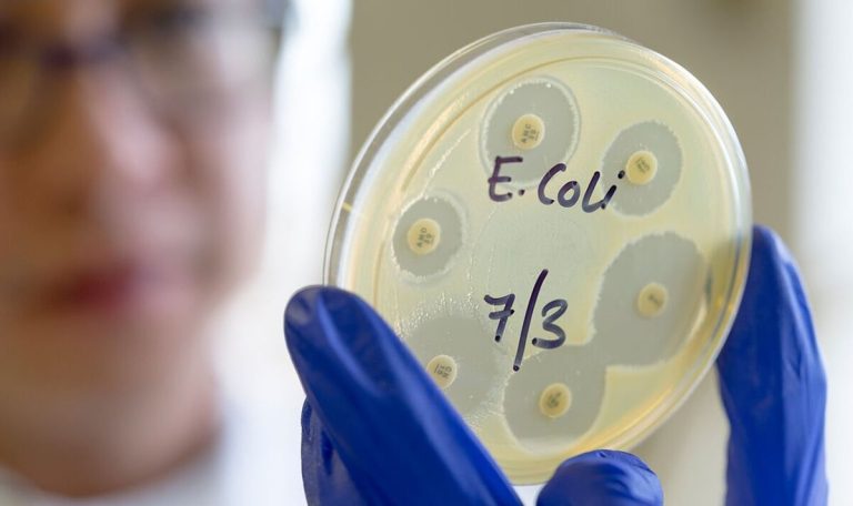 E. Coli Outbreak Linked to Cheese Products Claims Life in the UK: What You Need to Know