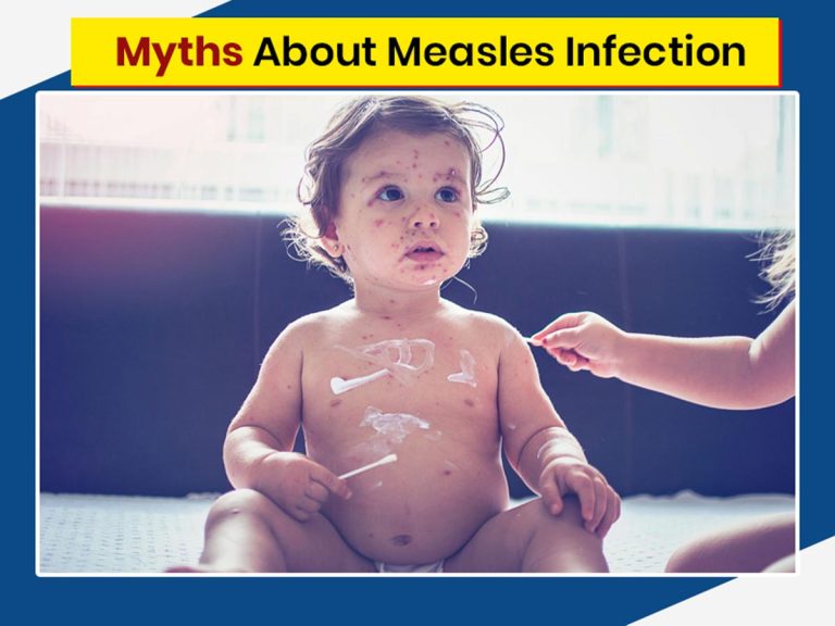 Understanding the Impact of the Recent Measles Outbreak in US: Vital Insights