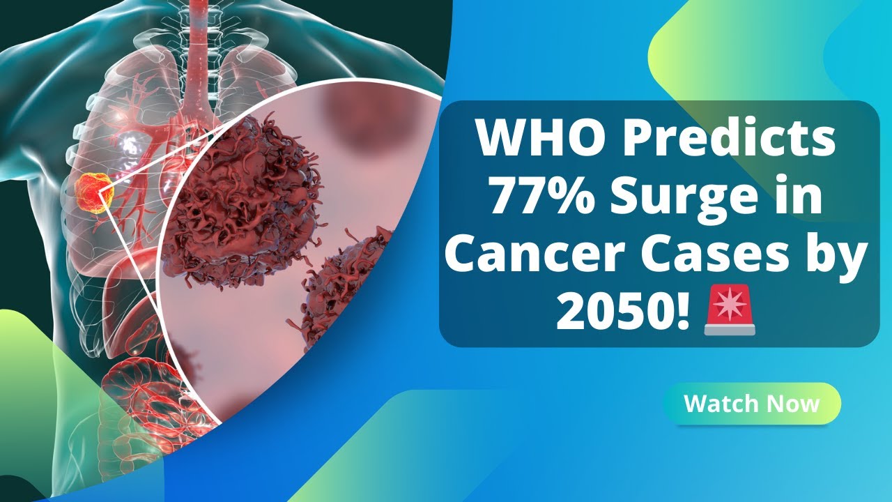 Latest News on Cancer Research: Global Cancer Cases Projected to Surge by 77% by 2050