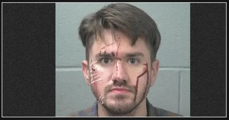 Texas Man Allegedly Self-Inflicts Facial Injuries with Razor Blade in Attempt to Falsely Accuse Girlfriend of Assault